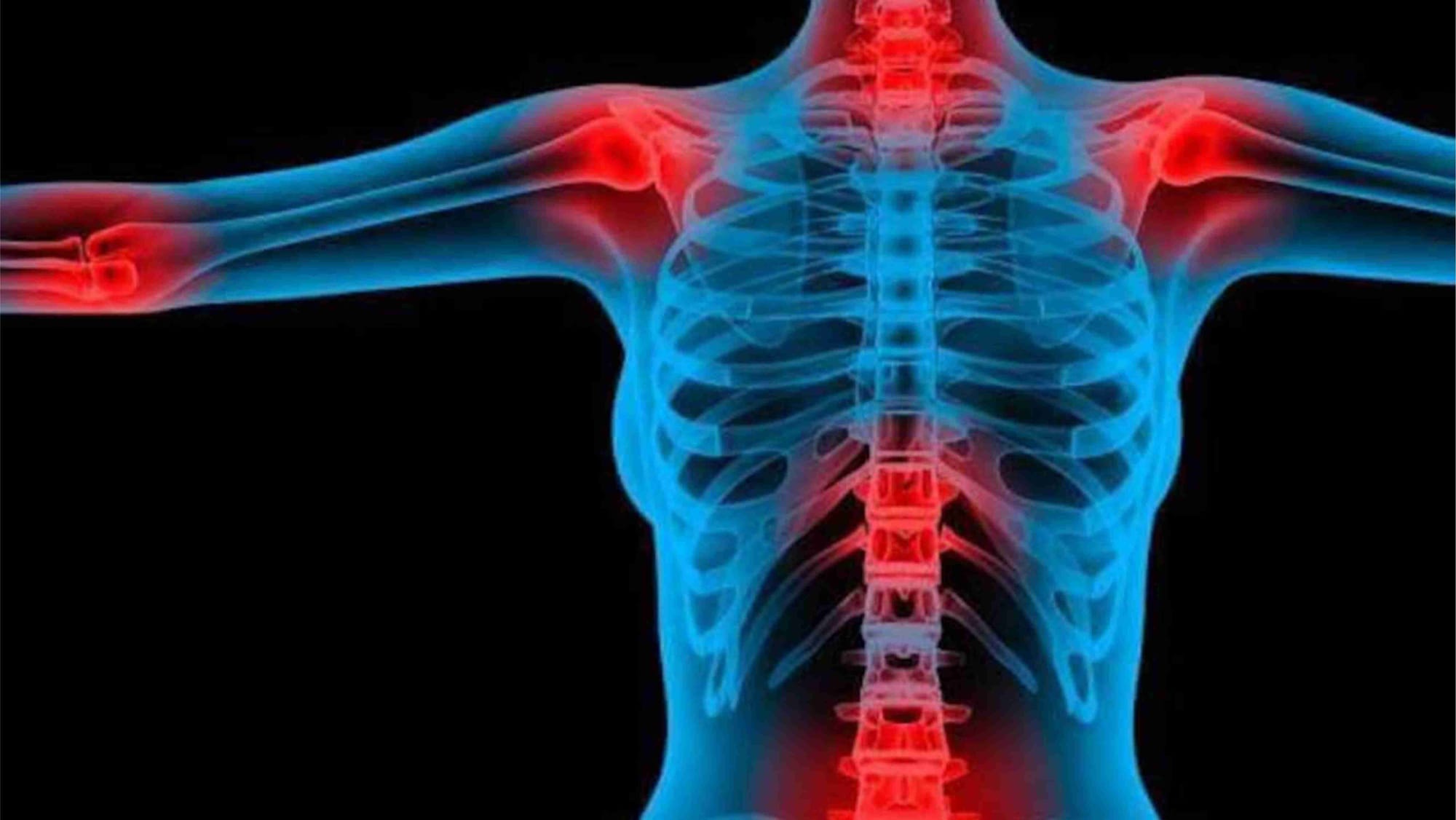 Várzea Grande institui Semana Municipal de Conscientização sobre a Fibromialgia