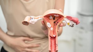 MARÇO AMARELO: Endometriose afeta mais de 7 milhões de brasileiras e pode levar anos para ser diagnosticada